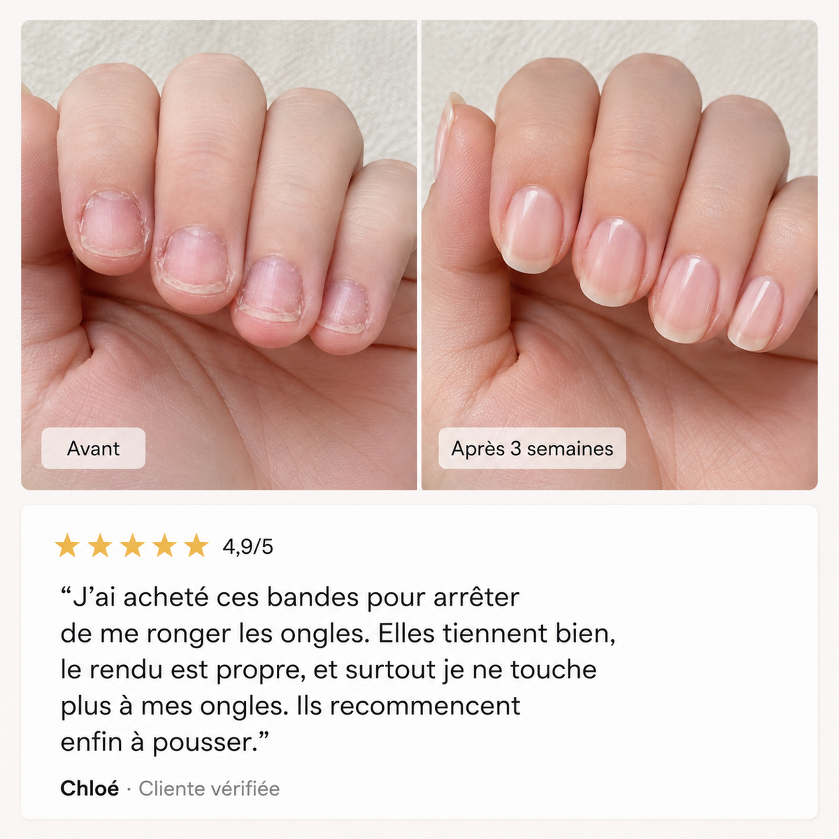 MediGel Nail Strip