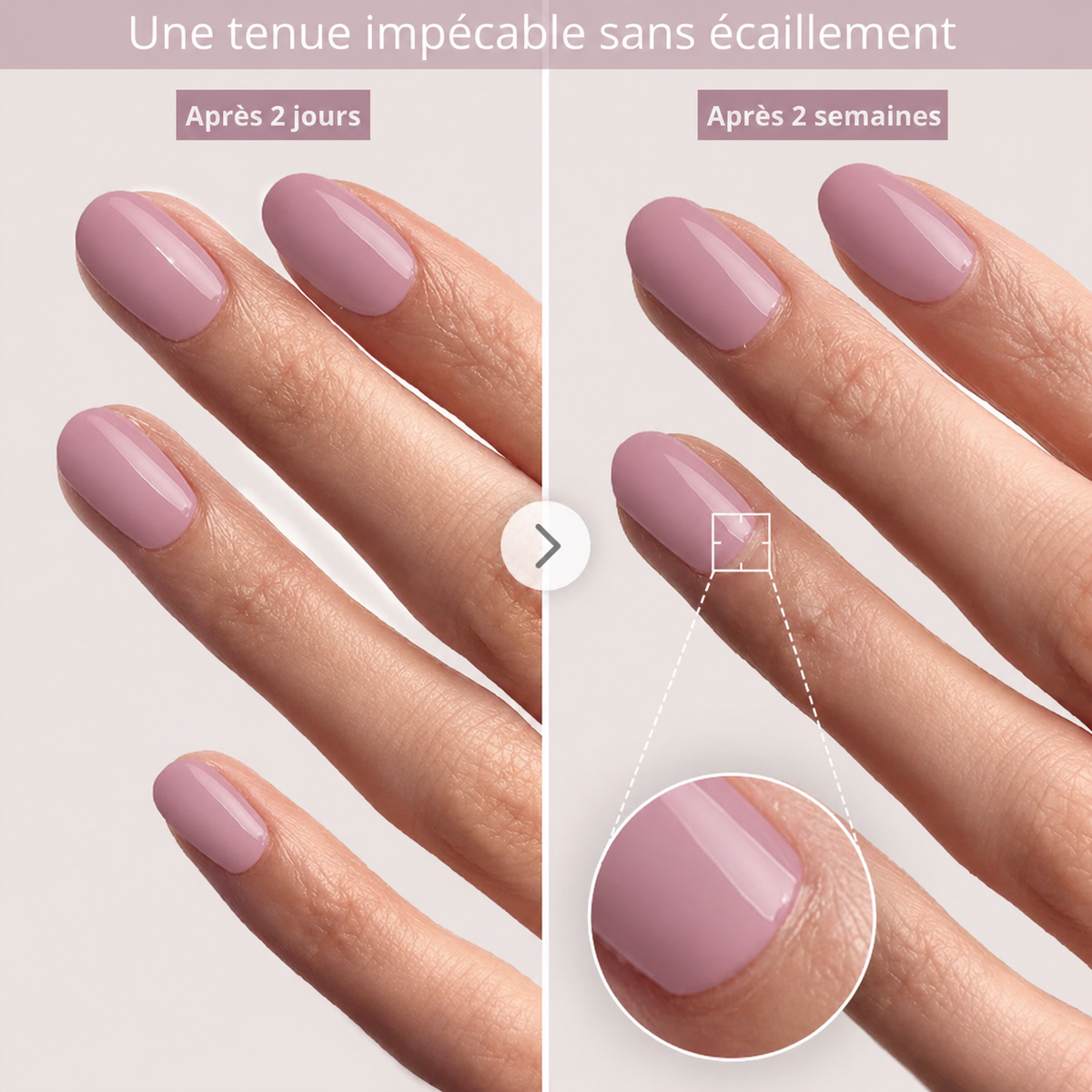 MediGel Nail Strip